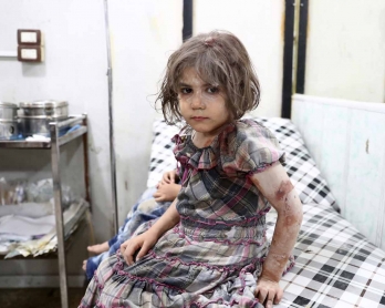 An injured Syrian child poses as she awaits treatment at a makeshift hospital following a reported air stike on the rebel-held town of Douma, east of the capital Damascus, on August 23, 2016.
