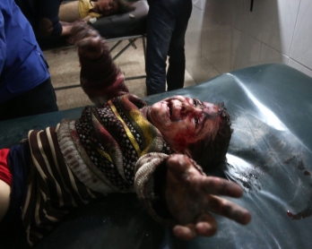 A Syrian child injured in government bombing cries as he receives treatment at make-shift hospital in the rebel-held town of Hamouria, in the besieged Eastern Ghouta region on the outskirts of the capital Damascus, on February 19, 2018.